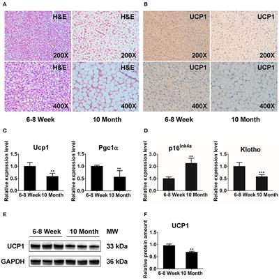 An Integrated Analysis of mRNA and lncRNA Expression Profiles Indicates Their Potential Contribution to Brown Fat Dysfunction With Aging